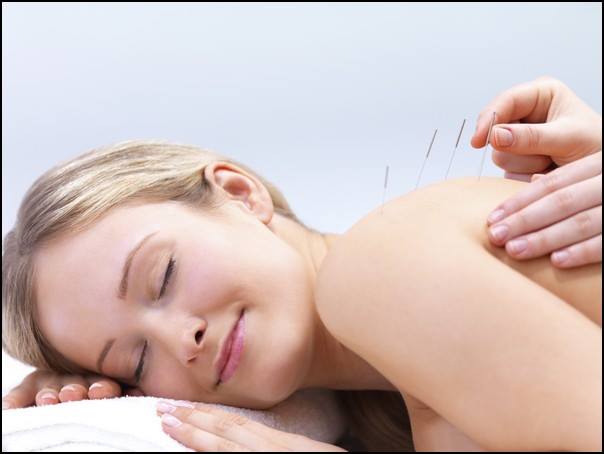 Acupuncture Therapy for Cancer