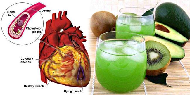 Homemade Drink to Prevent a Stroke Naturally