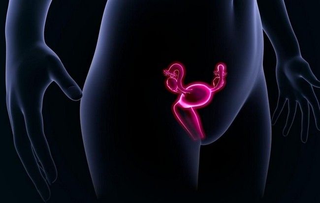 Cancerous Tumor on Ovary
