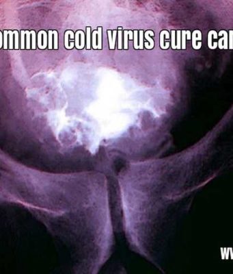 Can common cold virus cure cancer?