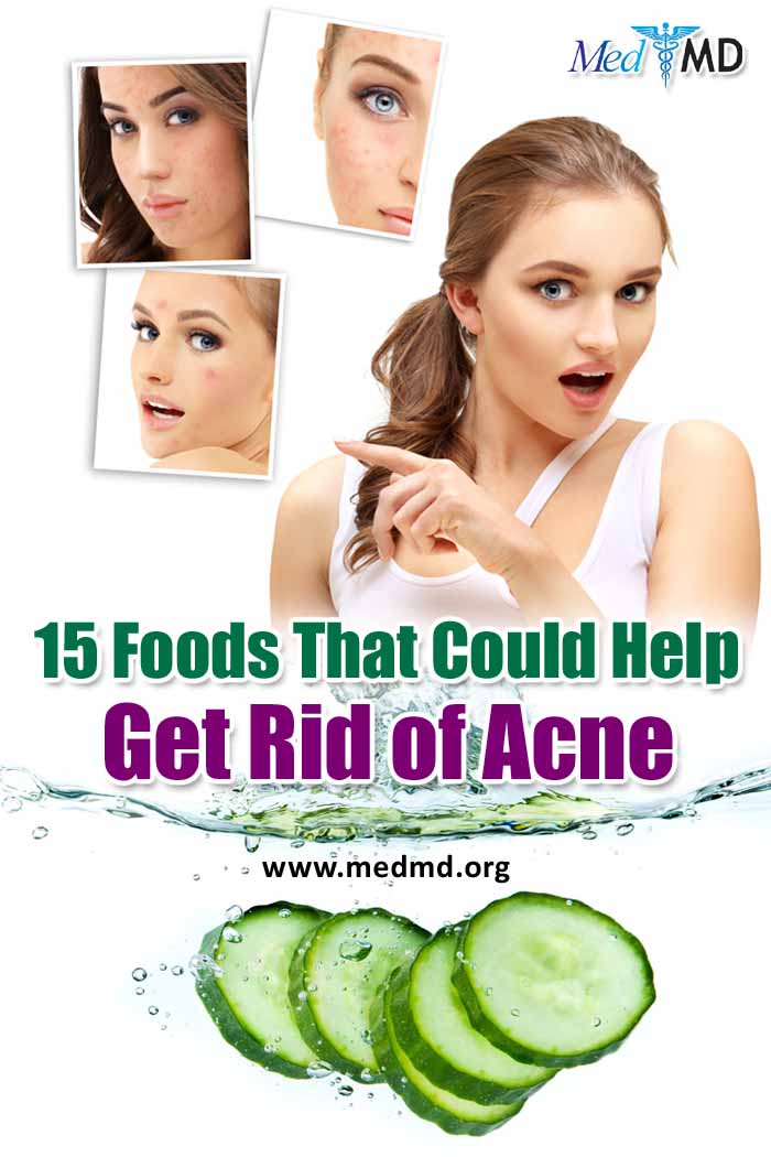 15 Foods That Could Help Get Rid of Acne