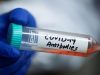 Antibody Tests and Coronavirus Immunity